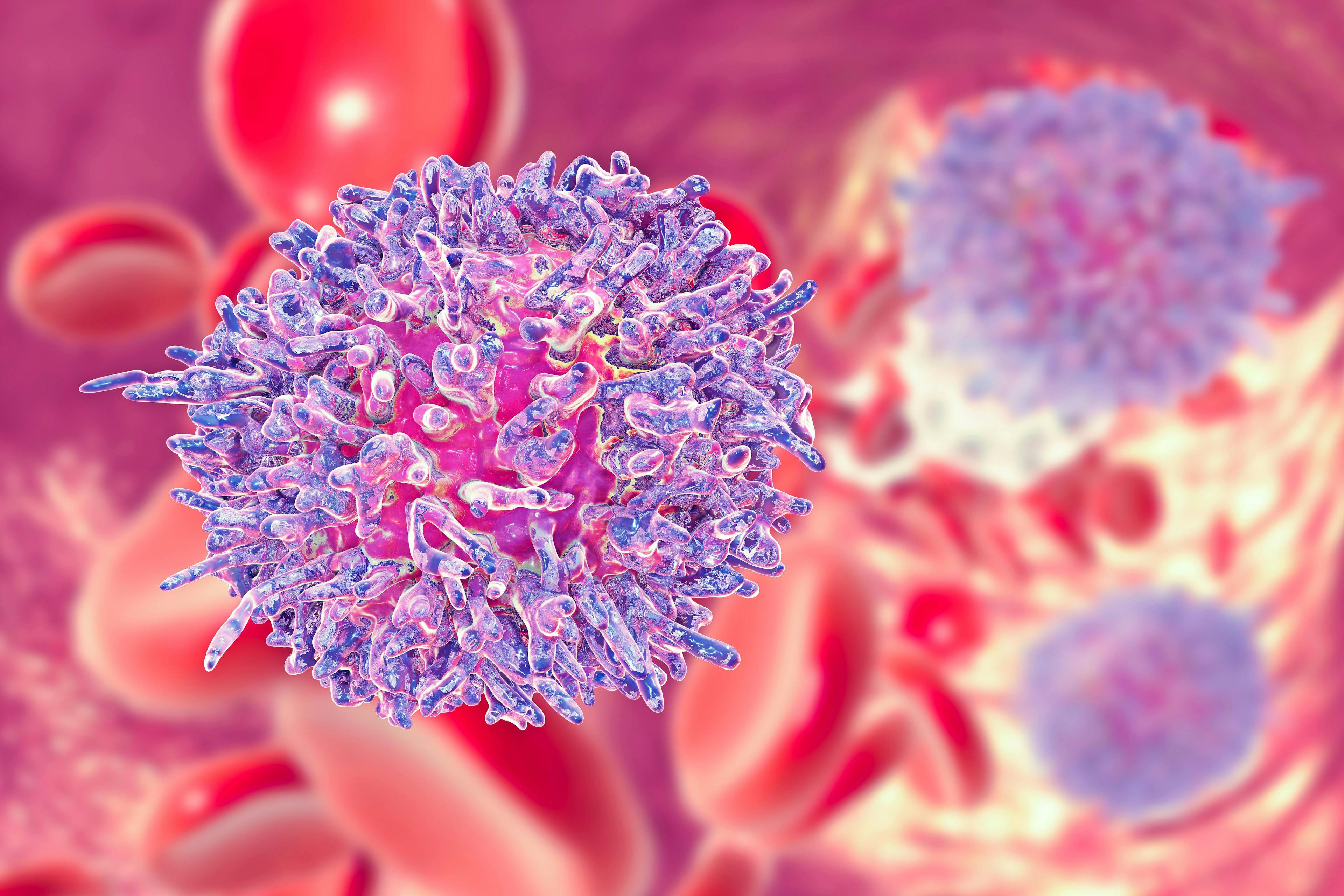Image credit: Dr_Microbe | stock.adobe.com. Hairy cell leukemia, 3D illustration. It is a hematological malignancy, chronic lymphocytic leukemia, with accumulation of abnormal B lymphocytes