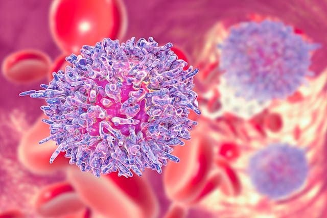 Image credit: Dr_Microbe | stock.adobe.com. Hairy cell leukemia, 3D illustration. It is a hematological malignancy, chronic lymphocytic leukemia, with accumulation of abnormal B lymphocytes