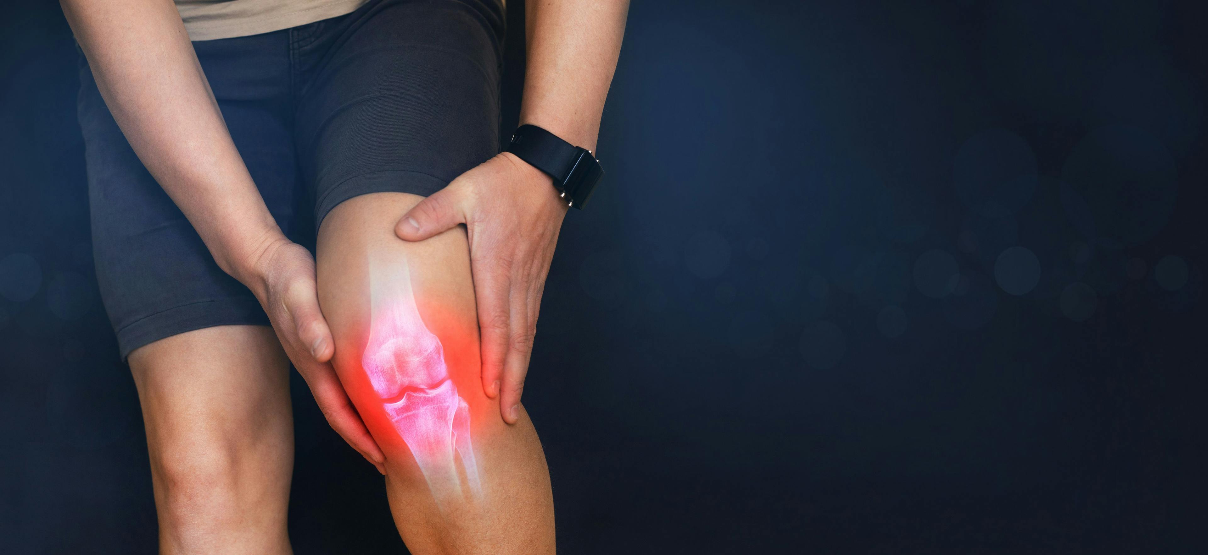 Digital bone of human leg. Man suffering from knee pain | Image Credit: © Miha Creative - stock.adobe.com
